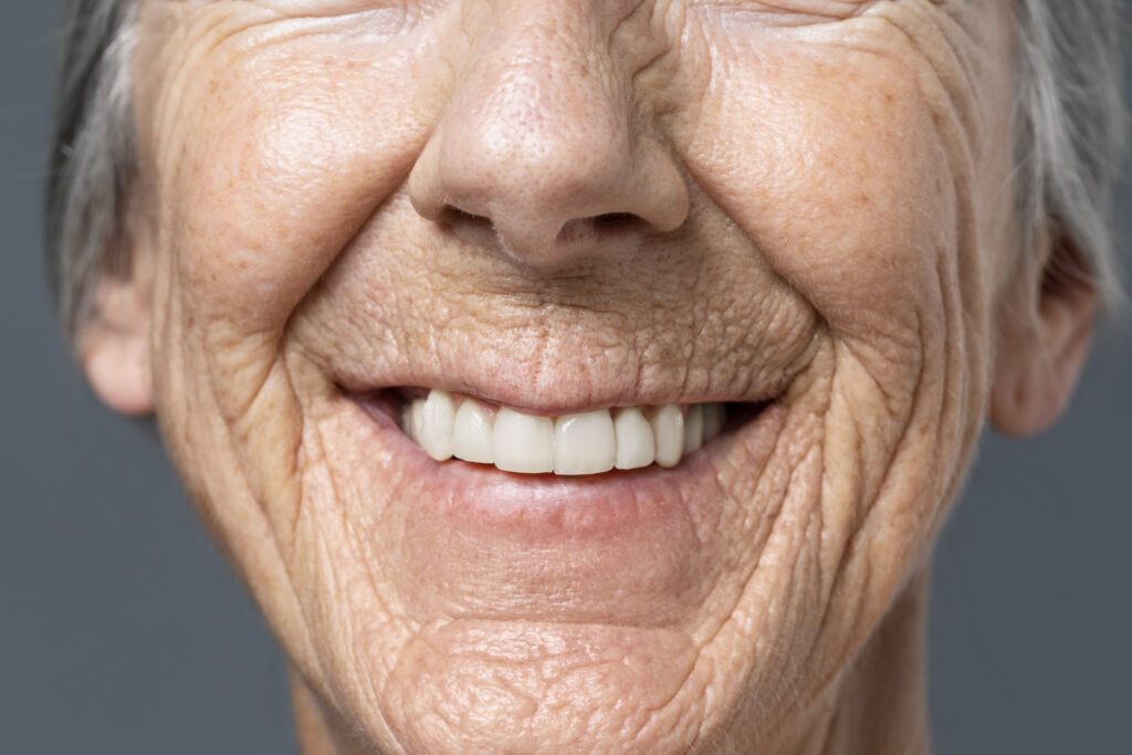 Perda de dentes desafia envelhecimento saudável no Brasil